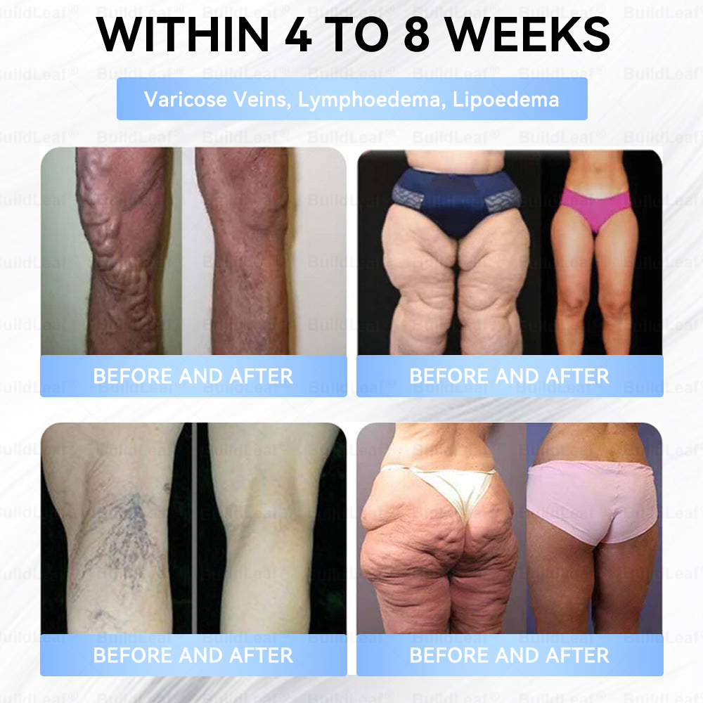 🏥FDA Store |𝐵uil𝗱𝐿ea𝐟® 𝑮𝐋𝑃-1 Slim & Firm 𝑁ano 𝑀icroneedle 𝑃atch with Collagen,Turmeric&Matrixyl 3000 丨Obesity,Cardiovascular Diseas, Diabetes, Sleep Apnea, Joint Problems and More